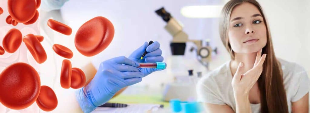 بهترین کیت prp