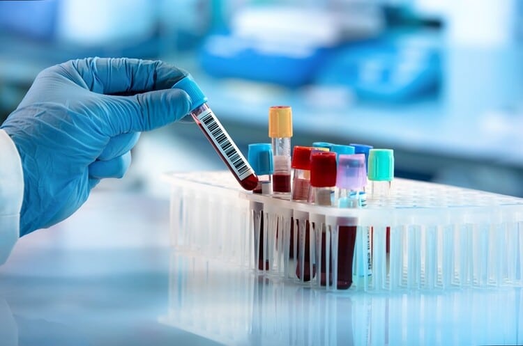 بهترین کیت prp